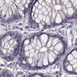 Invitrogen SLC28A2 Polyclonal Antibody 100 &mu;L; Unconjugated:Antibodies,
