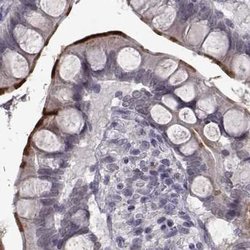 Invitrogen SLC28A2 Polyclonal Antibody 100 &mu;L; Unconjugated:Antibodies,