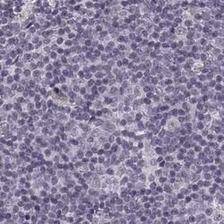 Invitrogen SLC28A2 Polyclonal Antibody 100 &mu;L; Unconjugated:Antibodies,