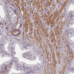 Invitrogen TNMD Polyclonal Antibody 100 &mu;L; Unconjugated:Antibodies,