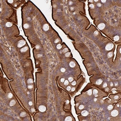 Invitrogen TNMD Polyclonal Antibody 100 &mu;L; Unconjugated:Antibodies,
