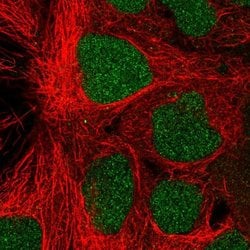 Invitrogen PROSER1 Polyclonal Antibody 100 &mu;L; Unconjugated:Antibodies,