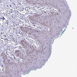 Invitrogen PROSER1 Polyclonal Antibody 100 &mu;L; Unconjugated:Antibodies,