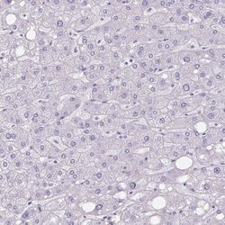 Invitrogen CHST3 Polyclonal Antibody 100 &mu;L; Unconjugated:Antibodies,