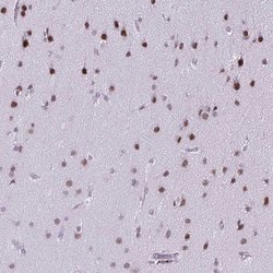 Invitrogen SS18 Polyclonal Antibody 100 &mu;L; Unconjugated:Antibodies,