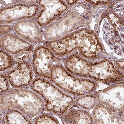 Invitrogen MRPS5 Polyclonal Antibody 100 &mu;L | Buy Online | Invitrogen&trade; | Fisher Scientific
