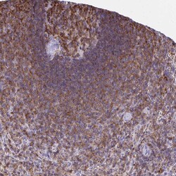 Invitrogen AP5M1 Polyclonal Antibody 100 &mu;L; Unconjugated:Antibodies,