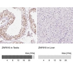 Invitrogen ZNF610 Polyclonal Antibody 100 &mu;L; Unconjugated:Antibodies,