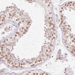 Invitrogen ZNF610 Polyclonal Antibody 100 &mu;L; Unconjugated:Antibodies,