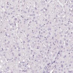 Invitrogen ZNF610 Polyclonal Antibody 100 &mu;L; Unconjugated:Antibodies,