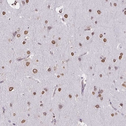 Invitrogen SEMA6B Polyclonal Antibody 100 &mu;L; Unconjugated:Antibodies,