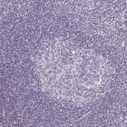 Invitrogen SEMA6B Polyclonal Antibody 100 &mu;L; Unconjugated:Antibodies,