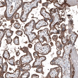 Invitrogen MXRA8 Polyclonal Antibody 100 &mu;L; Unconjugated:Antibodies,