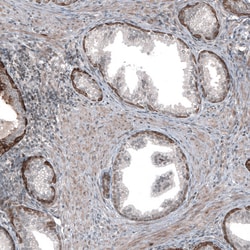 Invitrogen MXRA8 Polyclonal Antibody 100 &mu;L; Unconjugated:Antibodies,