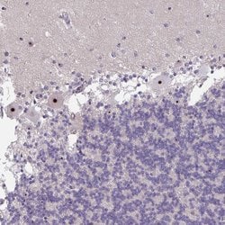 Invitrogen MXRA8 Polyclonal Antibody 100 &mu;L; Unconjugated:Antibodies,