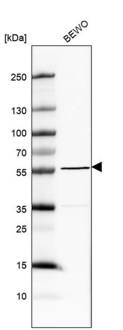 Invitrogen MXRA8 Polyclonal Antibody 100 &mu;L; Unconjugated:Antibodies,