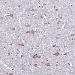 Invitrogen TMEM8C Polyclonal Antibody 100 &mu;L; Unconjugated:Antibodies,