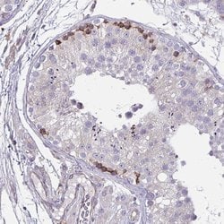 Invitrogen TMEM8C Polyclonal Antibody 100 &mu;L; Unconjugated:Antibodies,