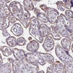 Invitrogen TMEM8C Polyclonal Antibody 100 &mu;L; Unconjugated:Antibodies,