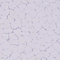Invitrogen TMEM8C Polyclonal Antibody 100 &mu;L; Unconjugated:Antibodies,