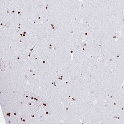 Invitrogen ZNF280C Polyclonal Antibody 100 &mu;L; Unconjugated:Antibodies,