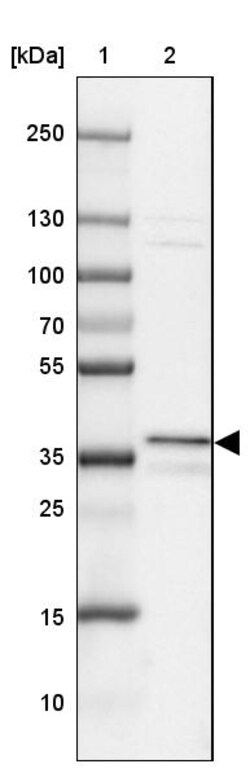 Invitrogen UNKL Polyclonal Antibody 100 &mu;L | Buy Online | Invitrogen&trade; | Fisher Scientific