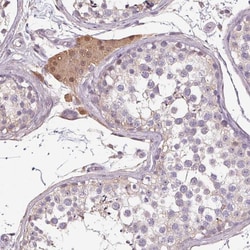 Invitrogen PRSS38 Polyclonal Antibody 100 &mu;L; Unconjugated:Antibodies,