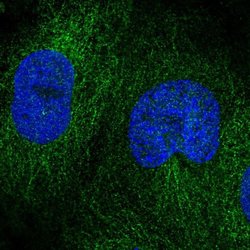 Invitrogen DOK4 Polyclonal Antibody 100 &mu;L; Unconjugated:Antibodies,