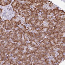 Invitrogen DOK4 Polyclonal Antibody 100 &mu;L; Unconjugated:Antibodies,