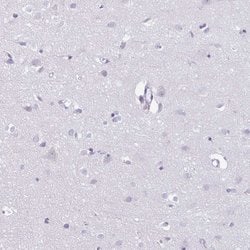 Invitrogen Azurocidin Polyclonal Antibody 100 &mu;L; Unconjugated:Antikroppar