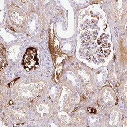Invitrogen Apolipoprotein C2 Polyclonal Antibody 100 &mu;L; Unconjugated:Antibodies,
