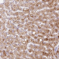 Invitrogen Apolipoprotein C2 Polyclonal Antibody 100 &mu;L; Unconjugated:Antibodies,