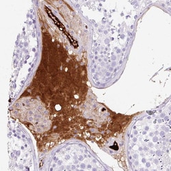 Invitrogen Apolipoprotein C2 Polyclonal Antibody 100 &mu;L; Unconjugated:Antibodies,