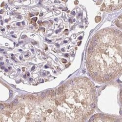 Invitrogen RPS5 Polyclonal Antibody 100 &mu;L; Unconjugated:Antibodies,