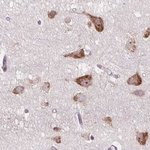 RPS5 Polyclonal Antibody, Invitrogen™