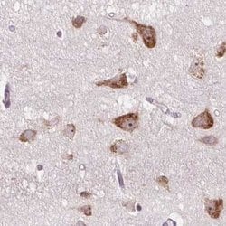 Invitrogen RPS5 Polyclonal Antibody 100 &mu;L; Unconjugated:Antibodies,