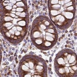 Invitrogen RPS5 Polyclonal Antibody 100 &mu;L; Unconjugated:Antibodies,