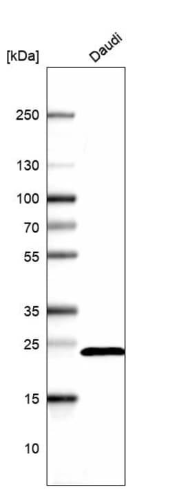 Invitrogen RPS5 Polyclonal Antibody 100 &mu;L; Unconjugated:Antibodies,