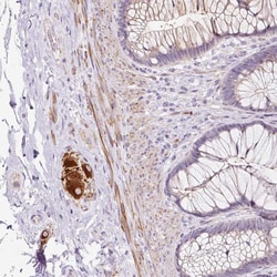 Invitrogen TECK Polyclonal Antibody 100 &mu;L; Unconjugated:Antibodies,