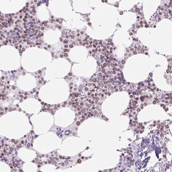 Invitrogen CD179a Polyclonal Antibody 100 &mu;L; Unconjugated:Antibodies,