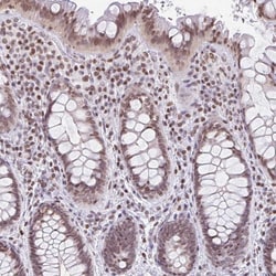 Invitrogen NOL6 Polyclonal Antibody 100 &mu;L; Unconjugated:Antibodies,