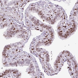 Invitrogen Histone H1.3 Polyclonal Antibody 100 &mu;L; Unconjugated:Antibodies,