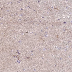 Invitrogen C2CD4C Polyclonal Antibody 100 &mu;L; Unconjugated:Antibodies,