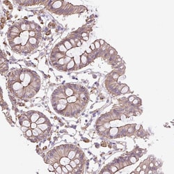 Invitrogen OR13D1 Polyclonal Antibody 100 &mu;L; Unconjugated:Antibodies,