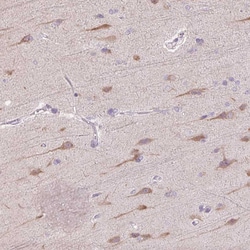 Invitrogen TMEM100 Polyclonal Antibody 100 &mu;L; Unconjugated:Antibodies,