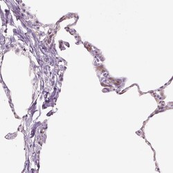Invitrogen TMEM100 Polyclonal Antibody 100 &mu;L; Unconjugated:Antibodies,