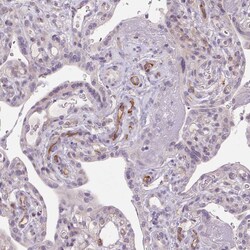Invitrogen TMEM100 Polyclonal Antibody 100 &mu;L; Unconjugated:Antibodies,