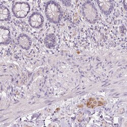 Invitrogen TMEM100 Polyclonal Antibody 100 &mu;L; Unconjugated:Antibodies,