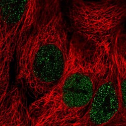 Invitrogen PLCXD2 Polyclonal Antibody 100 &mu;L; Unconjugated:Antibodies,