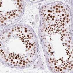 Invitrogen PLCXD2 Polyclonal Antibody 100 &mu;L; Unconjugated:Antibodies,